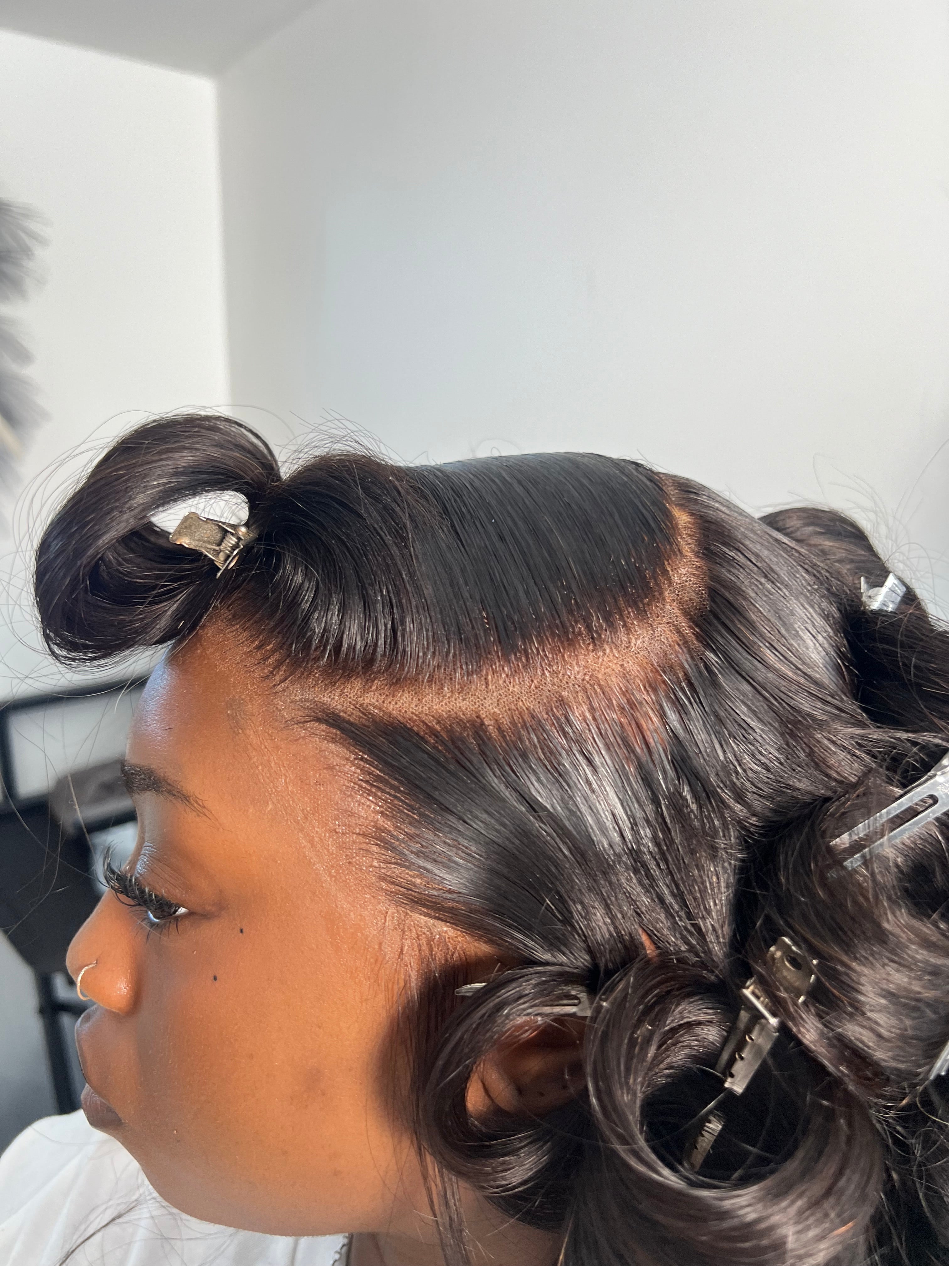 bundles and frontal